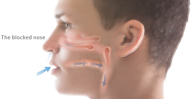 the-blocked-nose-sinus-surgical-treatment-brandon-hitchcock